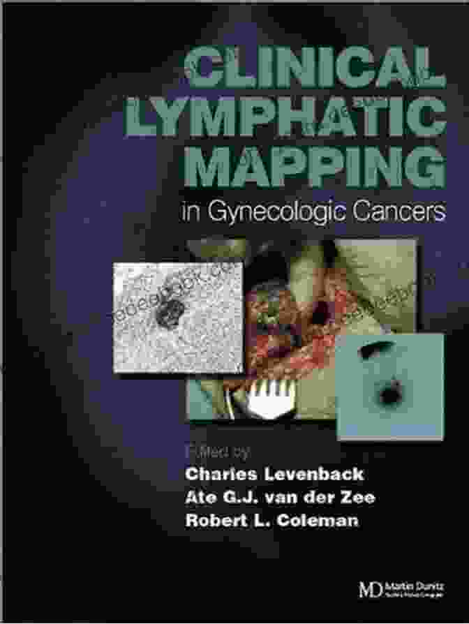 Clinical lymphatic mapping in gynecologic cancers