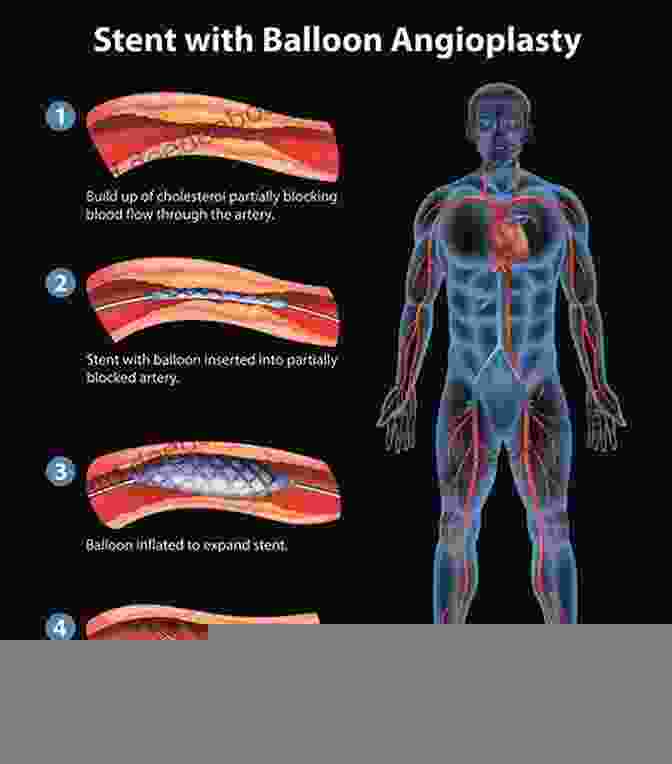 Percutaneous Coronary Intervention Dawn And Evolution Of Cardiac Procedures: Research Avenues In Cardiac Surgery And Interventional Cardiology