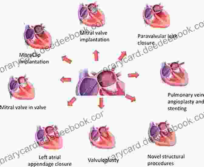 Structural Heart Disease Intervention Dawn And Evolution Of Cardiac Procedures: Research Avenues In Cardiac Surgery And Interventional Cardiology