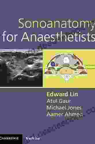 Sonoanatomy For Anaesthetists (Cambridge Medicine (Paperback))